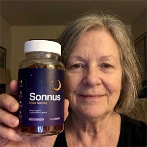 Sonnus customer